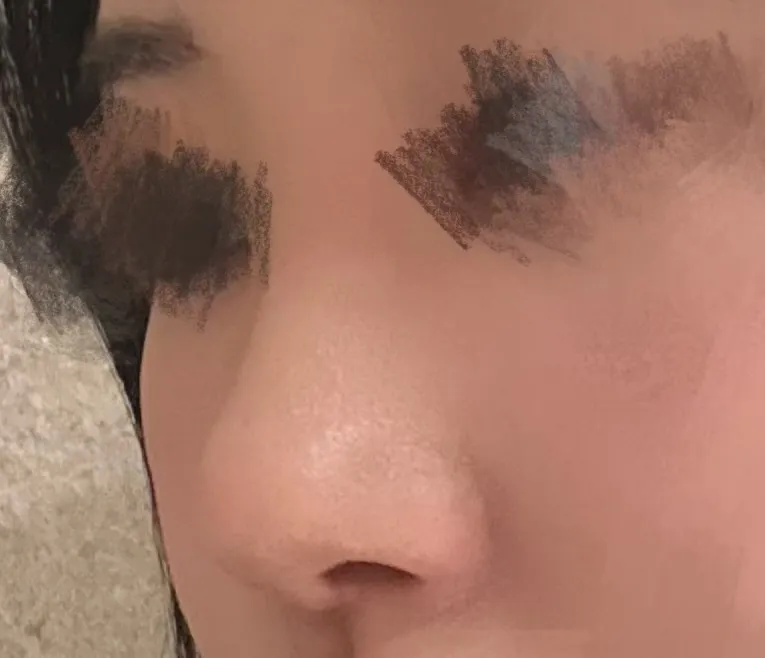 망한거 같은데 코 잘아는 언니 ..?3