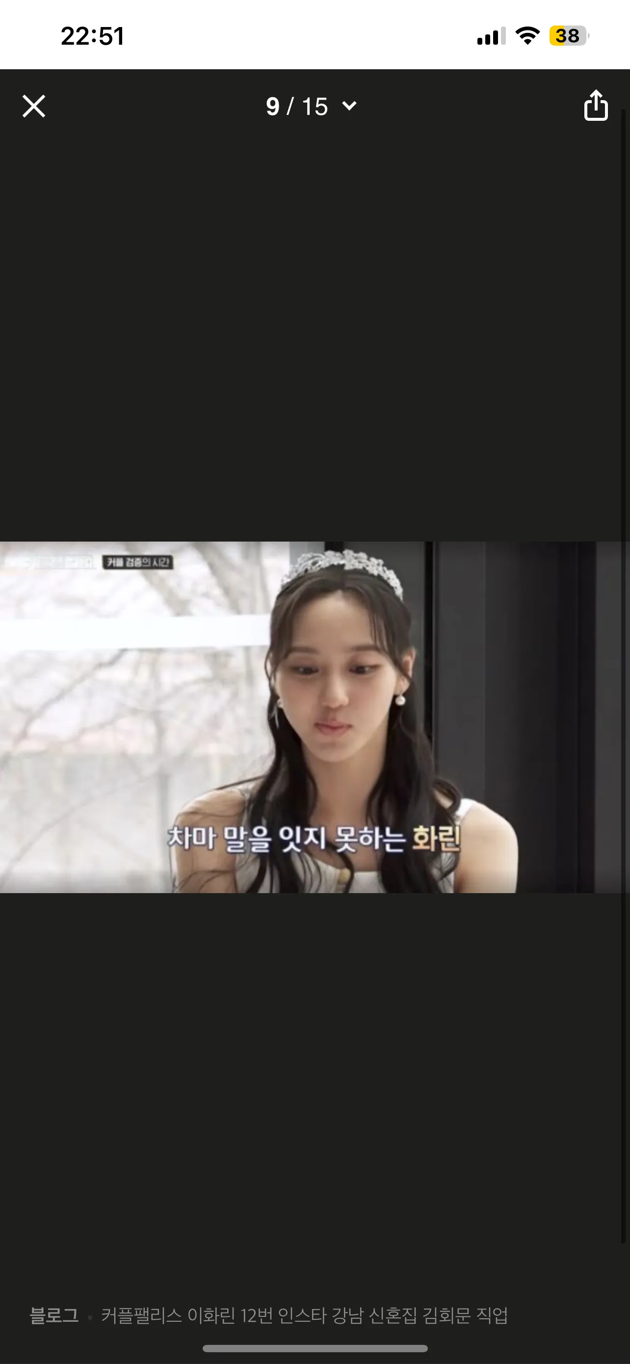 입돌아간건 양악 부작용인가여?