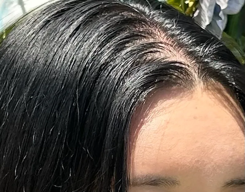 탈모왔어요.. 너무슬퍼요..또륵