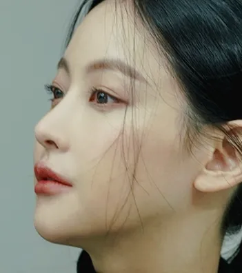 오연서 코3