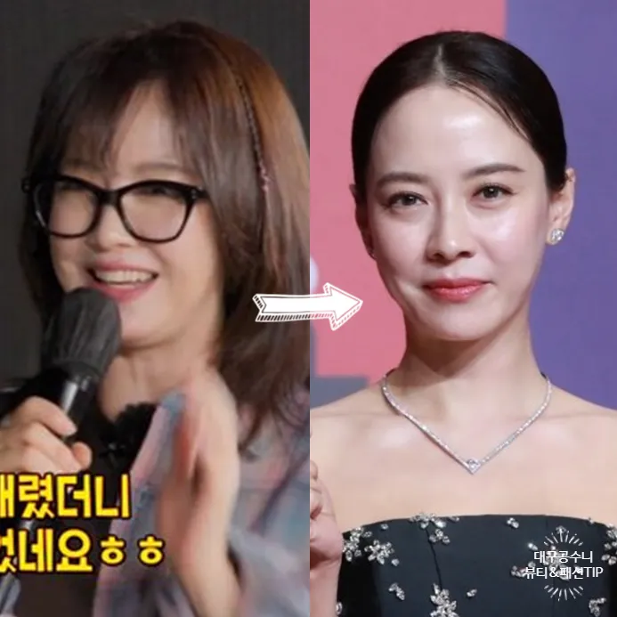 20대 아이돌들도 울쎄라 써마지 다 하나요?