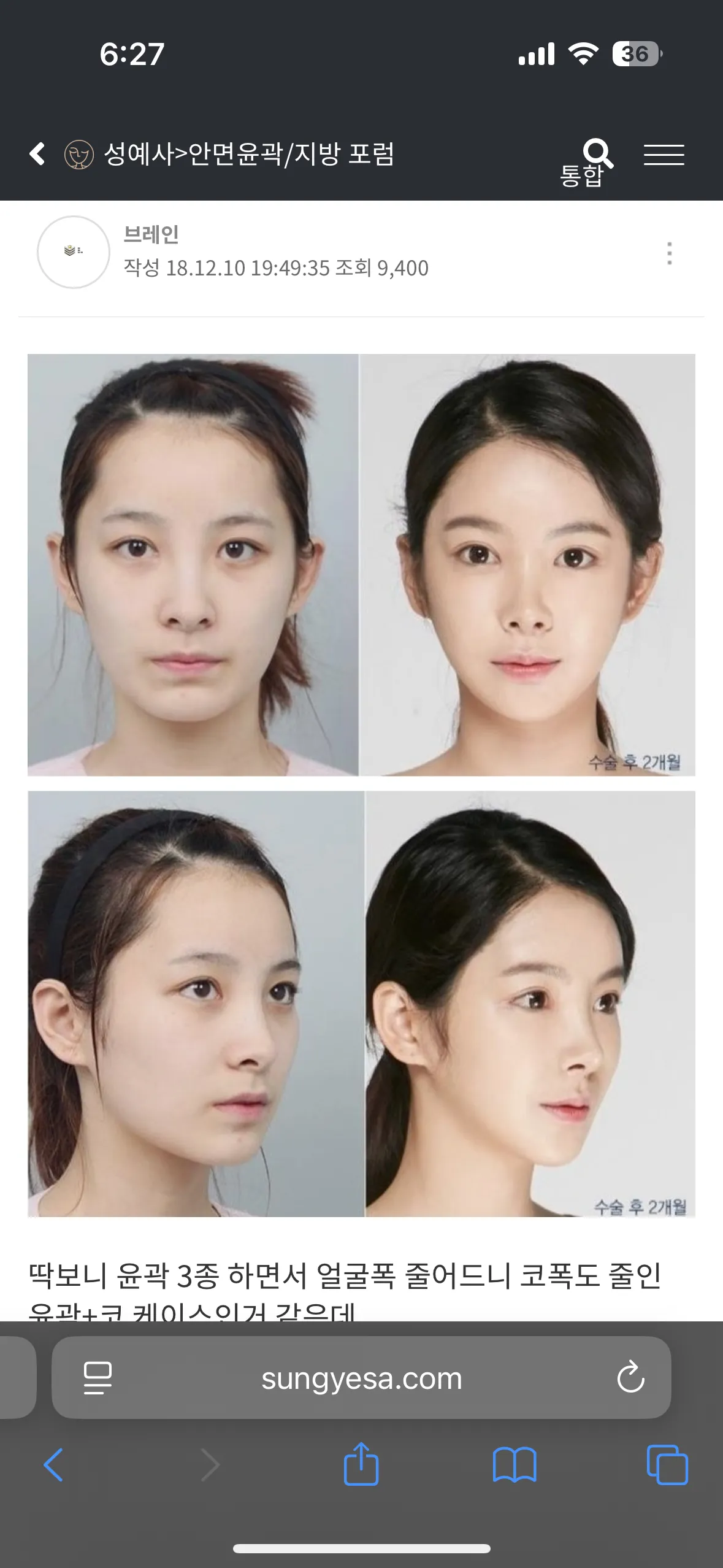 이분 왼쪽이 훨씬 예쁘시지않나요?