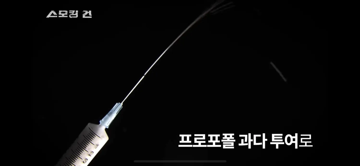 안검하수로 사망..