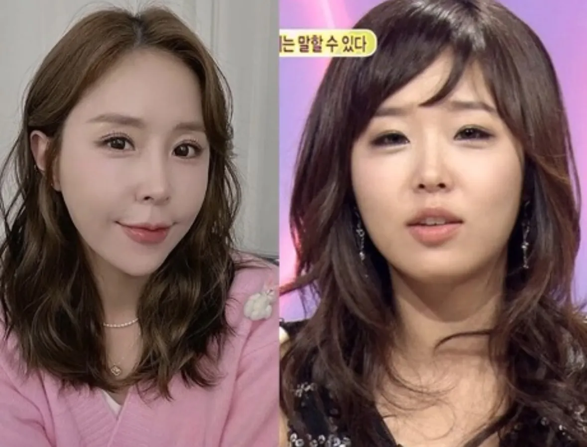 연예인들 왜 맨날 인중 팔자가 원숭이상이 되는거에요?