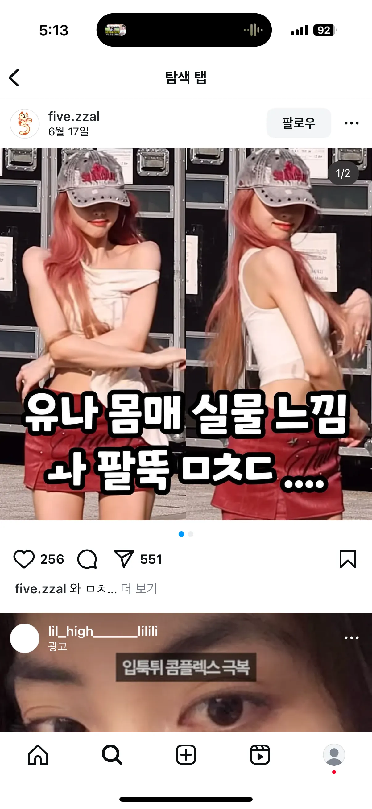 있지 유나 팔 지흡한건가??