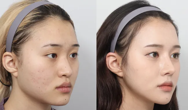 언니들이 이 언니였음 윤곽할거 같아요?