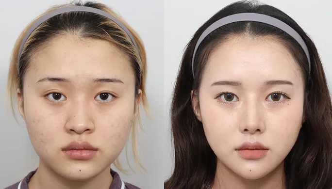 언니들이 이 언니였음 윤곽할거 같아요?2