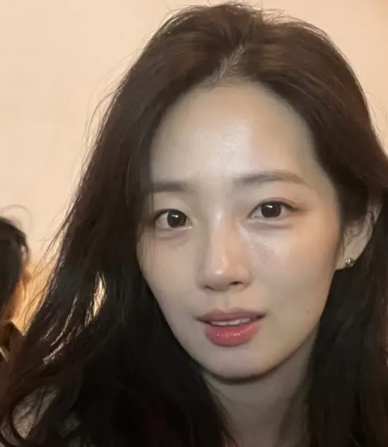 이 분 정도면 광대 수술 하실건가요