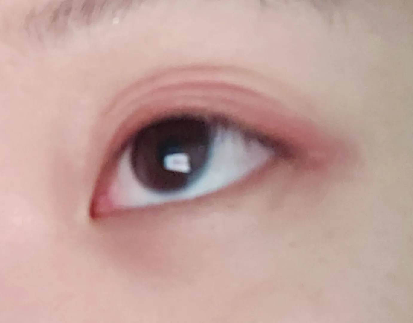 아 눈 서터레써(사진 냅다 눈 주의)