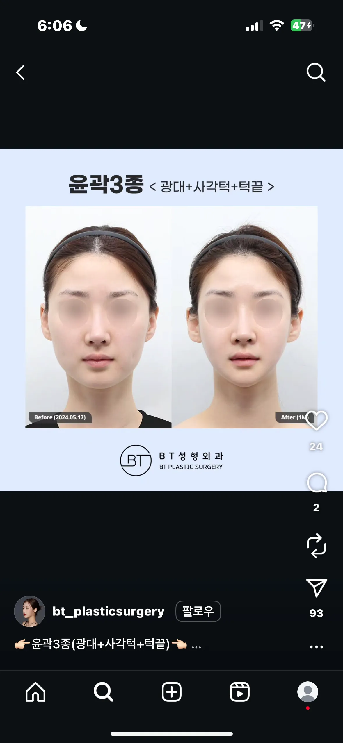 비티성형외과