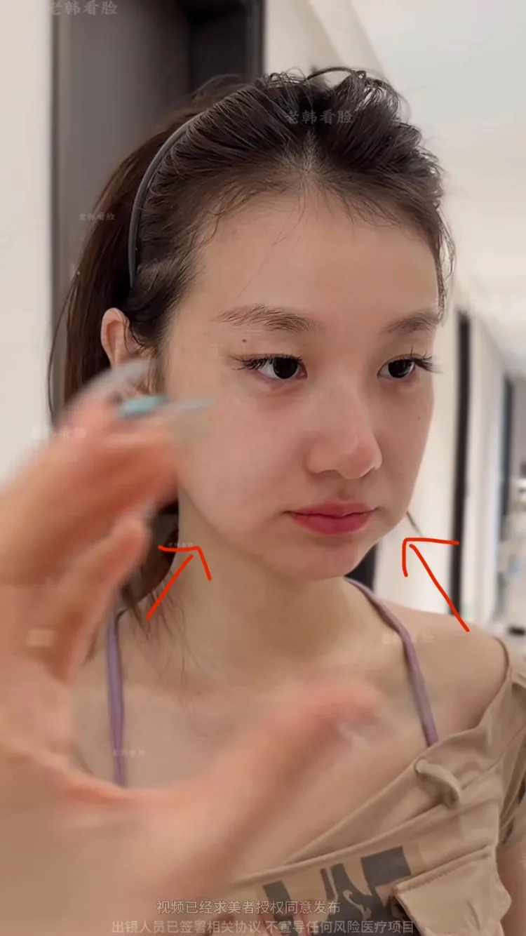 심부볼 이 릴스여자처럼 이러면 뭘 해야돼요?