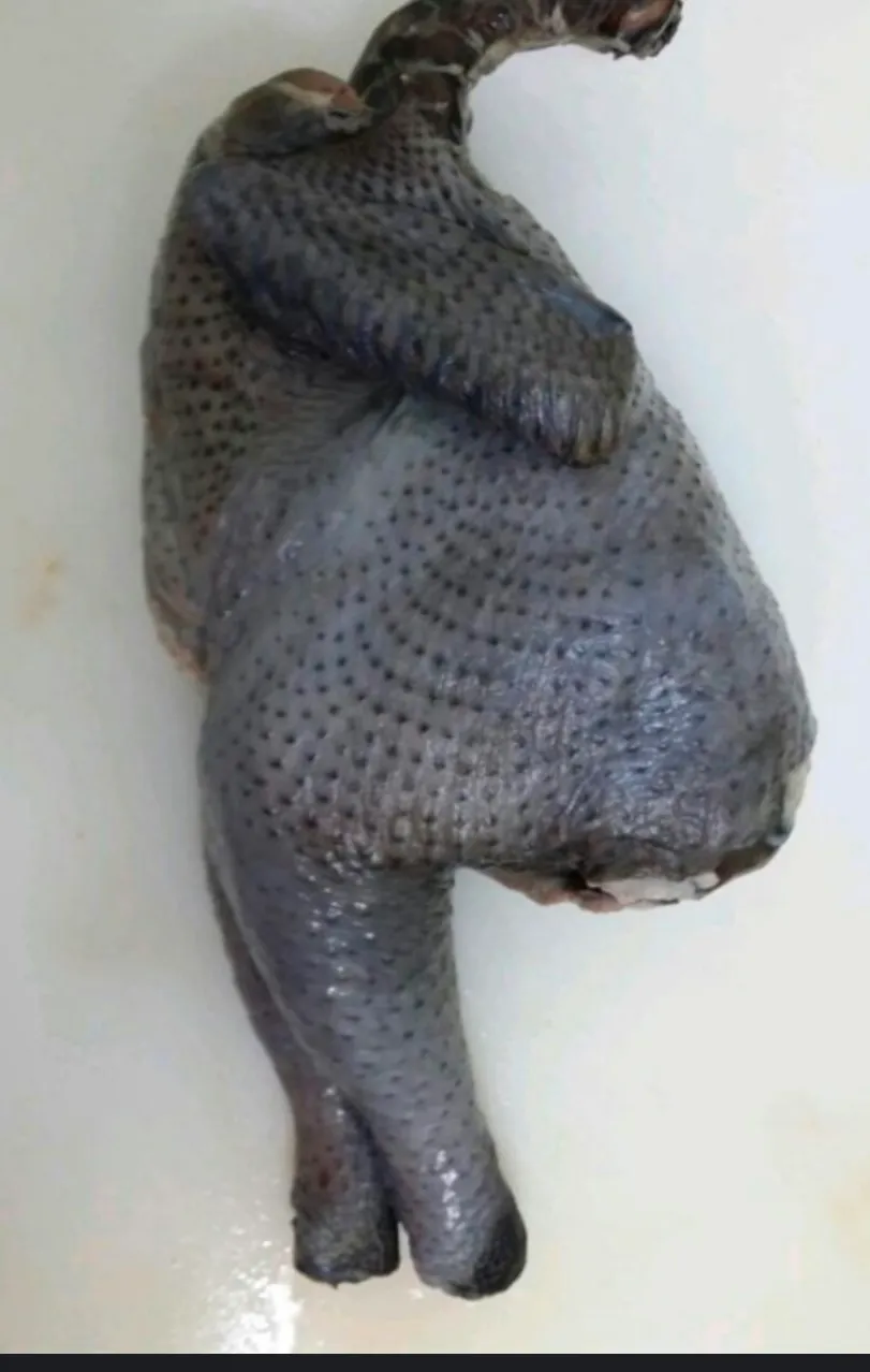 브라질리언 레이저 하신분
