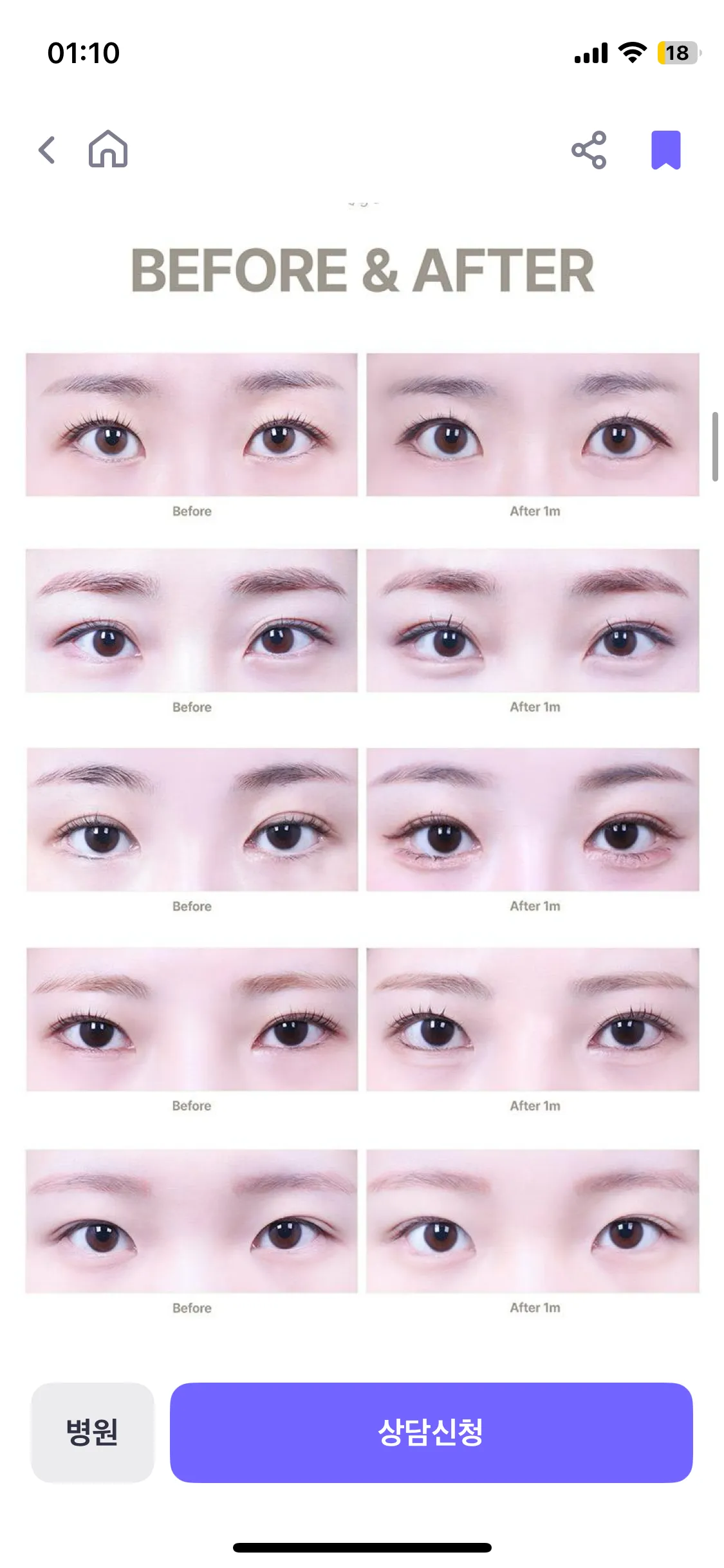 캔디트임 하신 언니 있을까요?