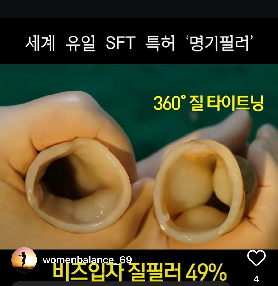 와ㅋㅋ이젠 하다하다 질 필러도 있네
