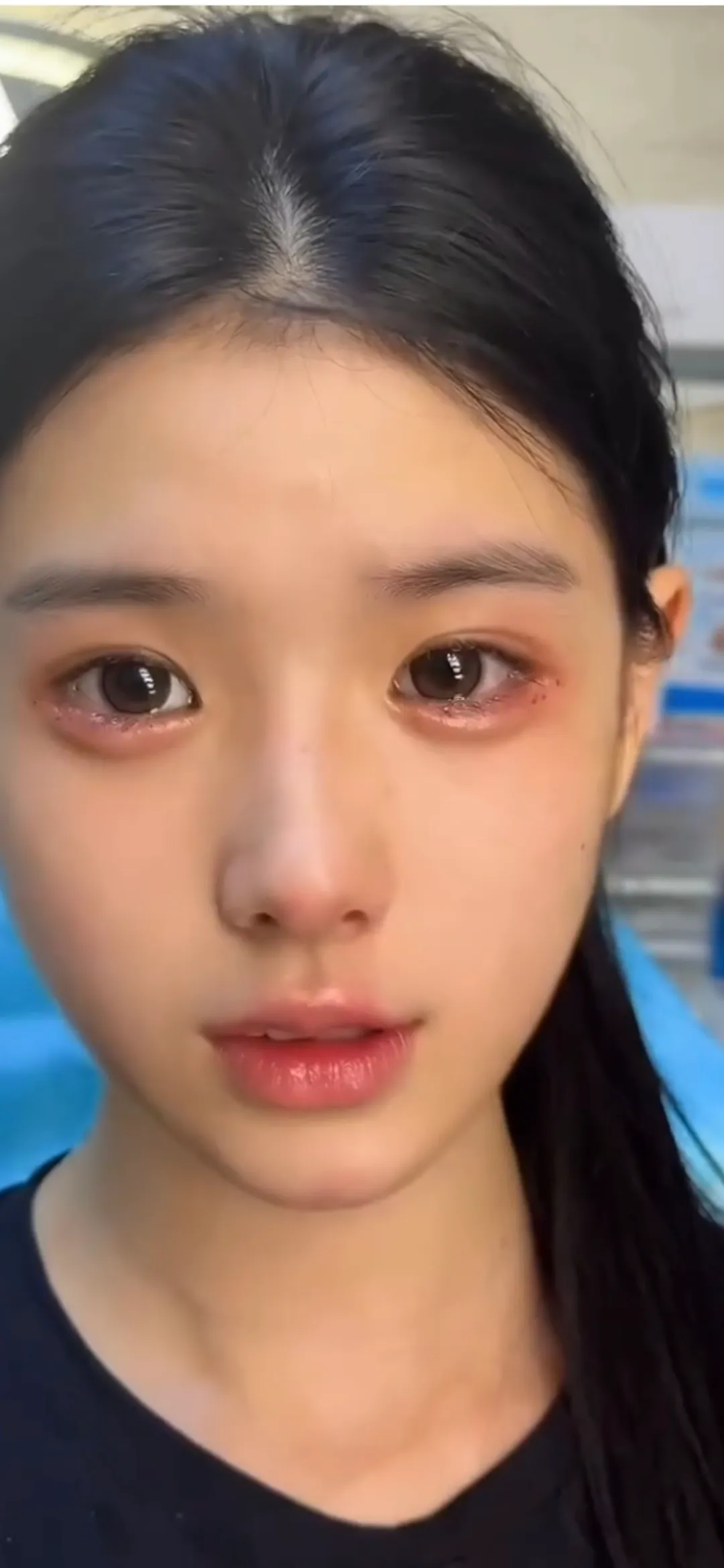 애교필러 어디서맞아야이렇게되나요...2