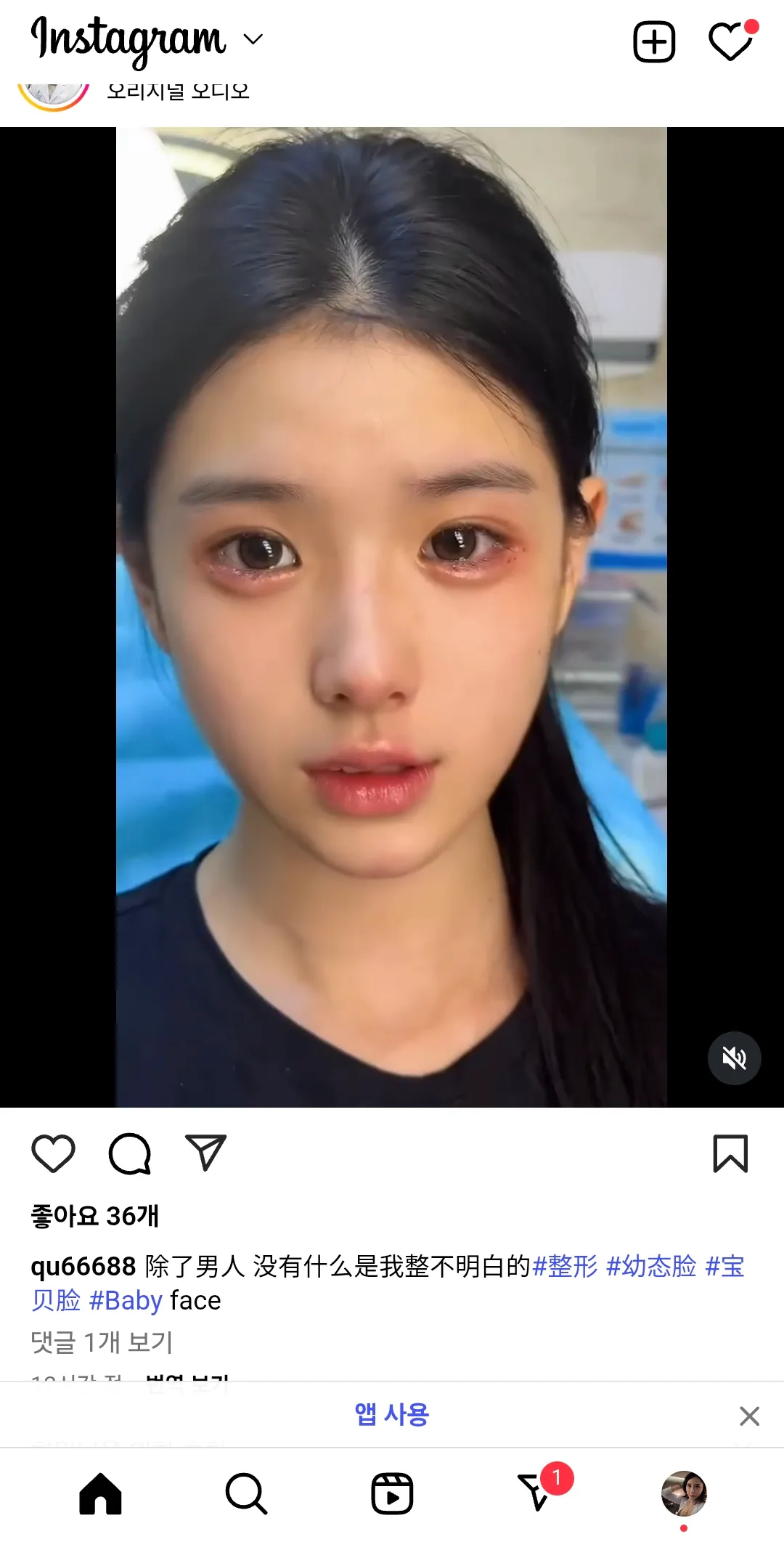 애교필러 어디서맞아야이렇게되나요...3