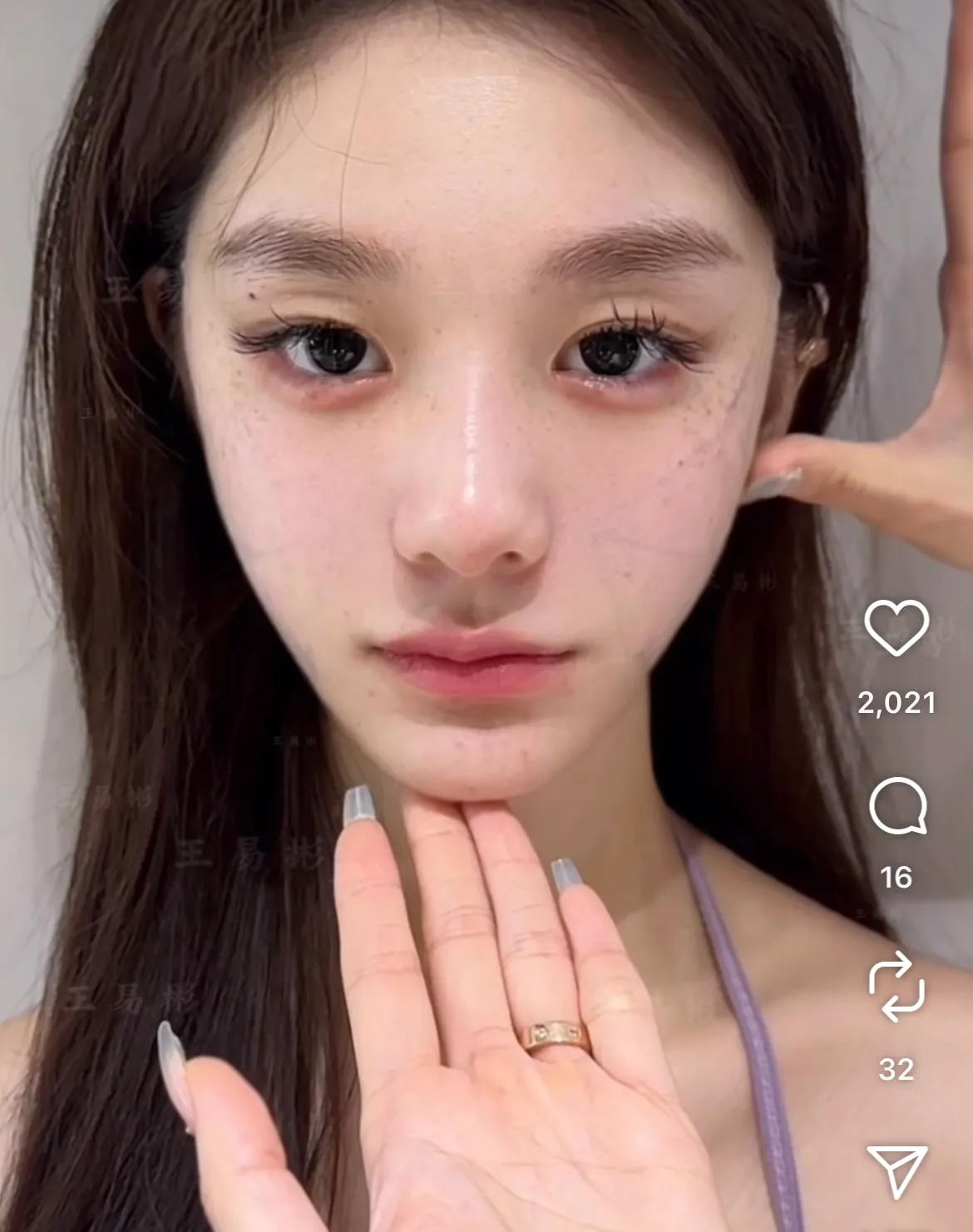 중국성형..2