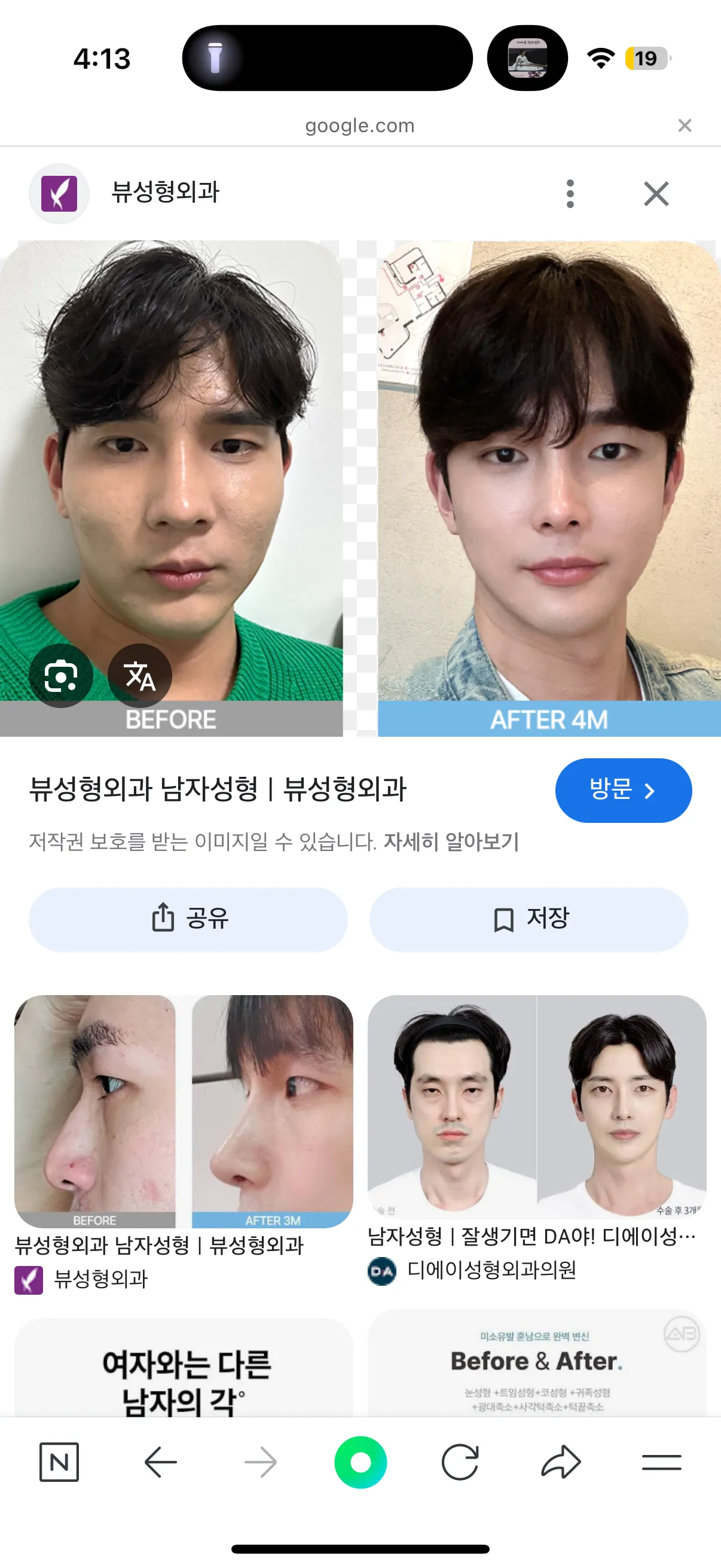 성형남들 ㅂㅅ 도라이 하자있는 이유