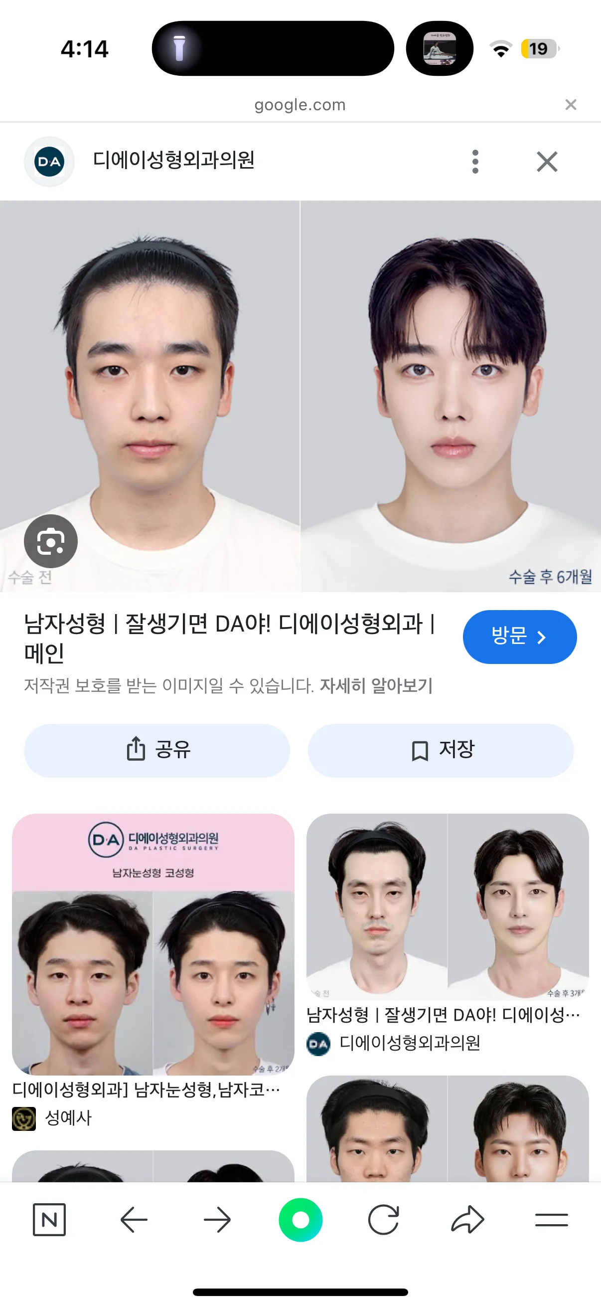 성형남들 ㅂㅅ 도라이 하자있는 이유2