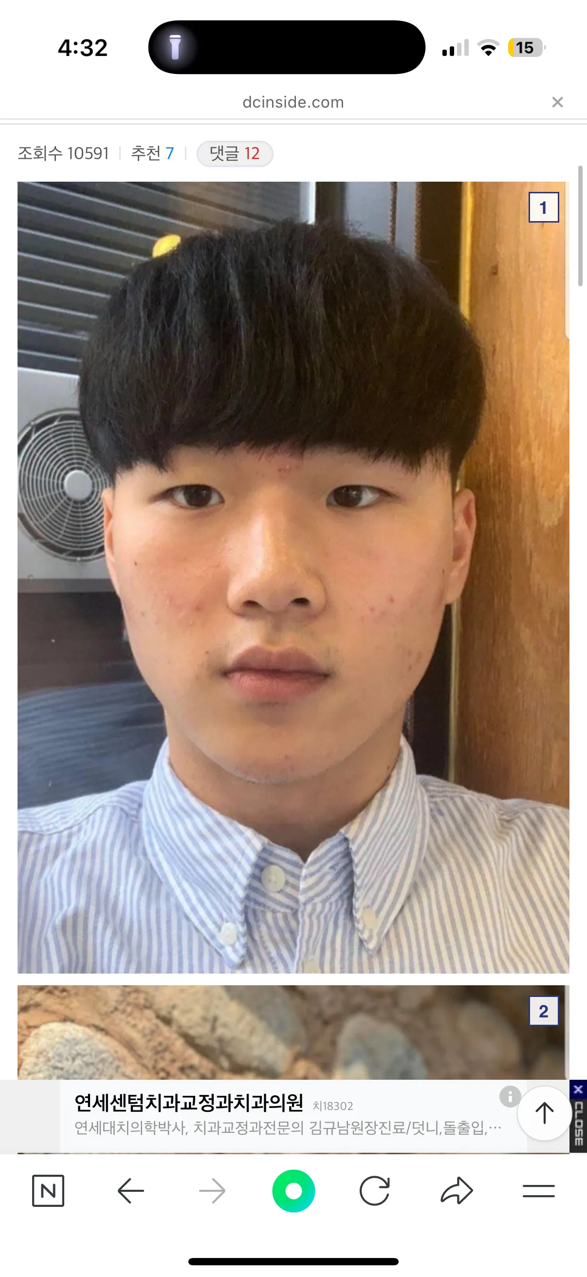 성형남들 ㅂㅅ 도라이 하자있는 이유 댓글