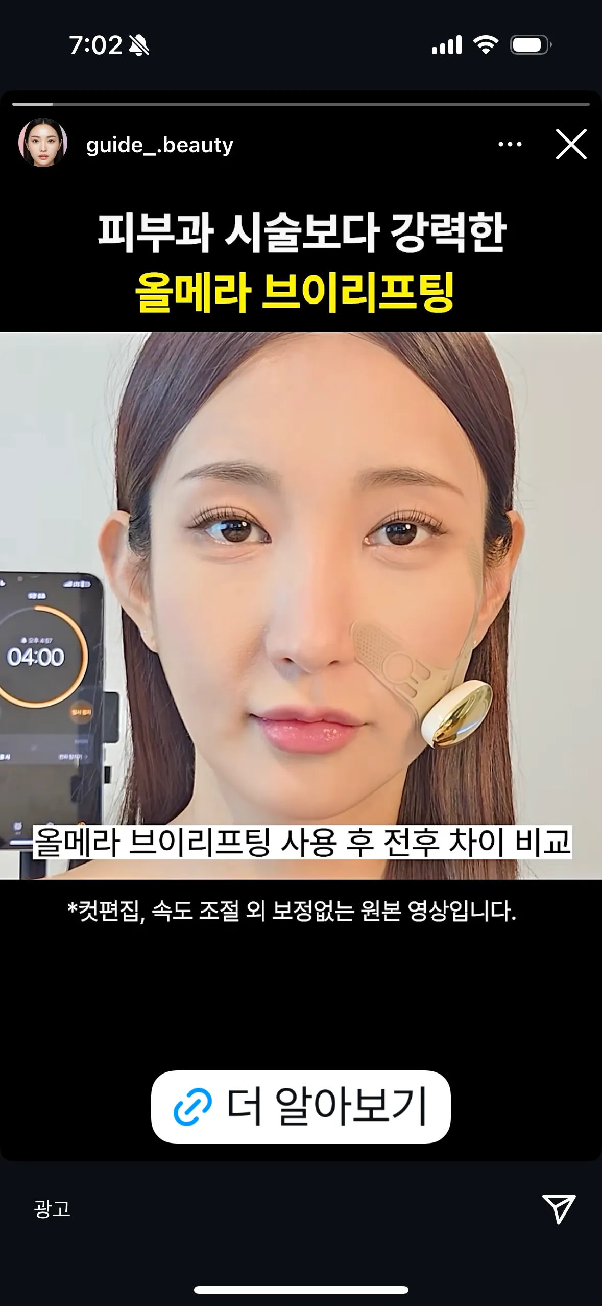 팔자 리프팅 이거 상술 일까요