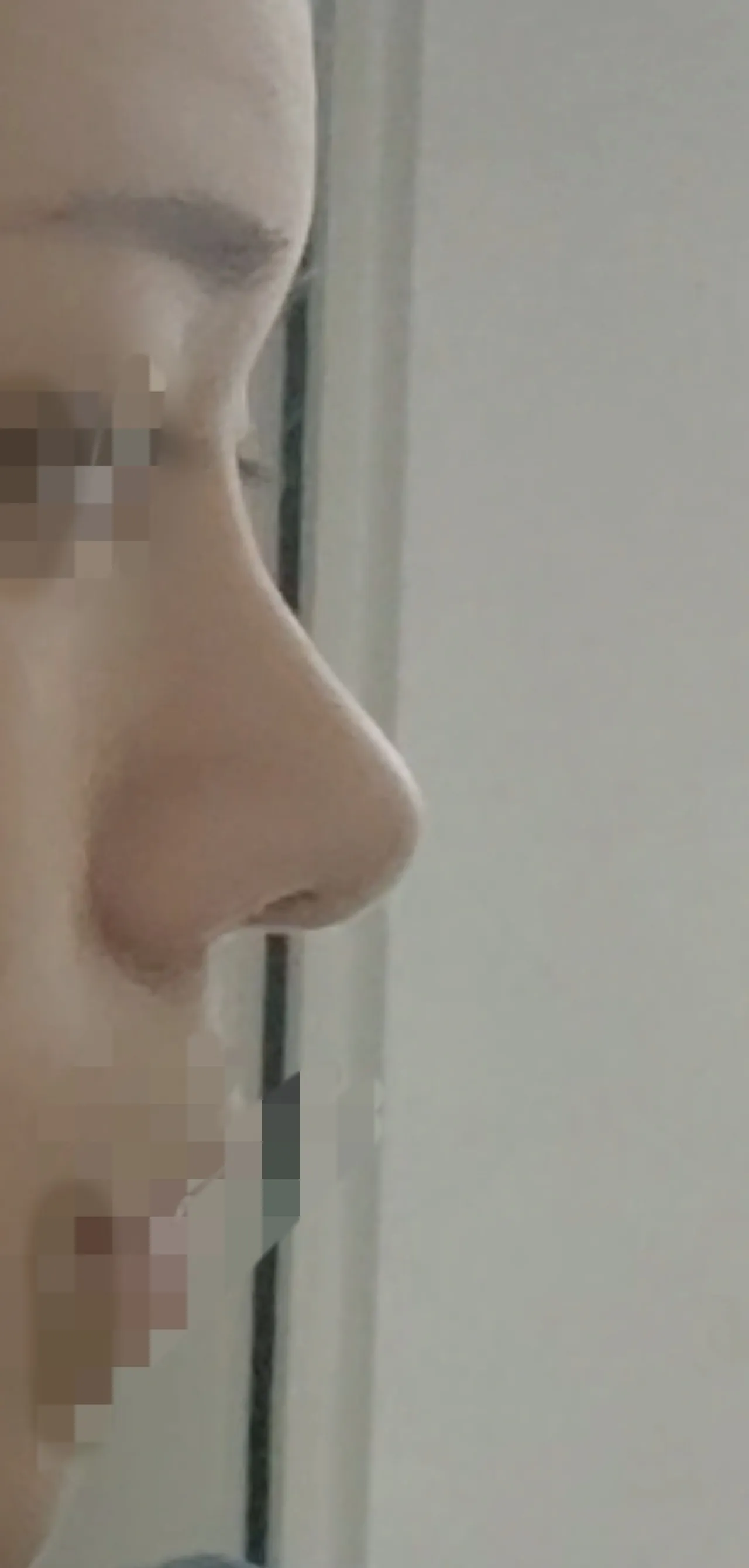 언니들 코 더 높이면 이상할까요?