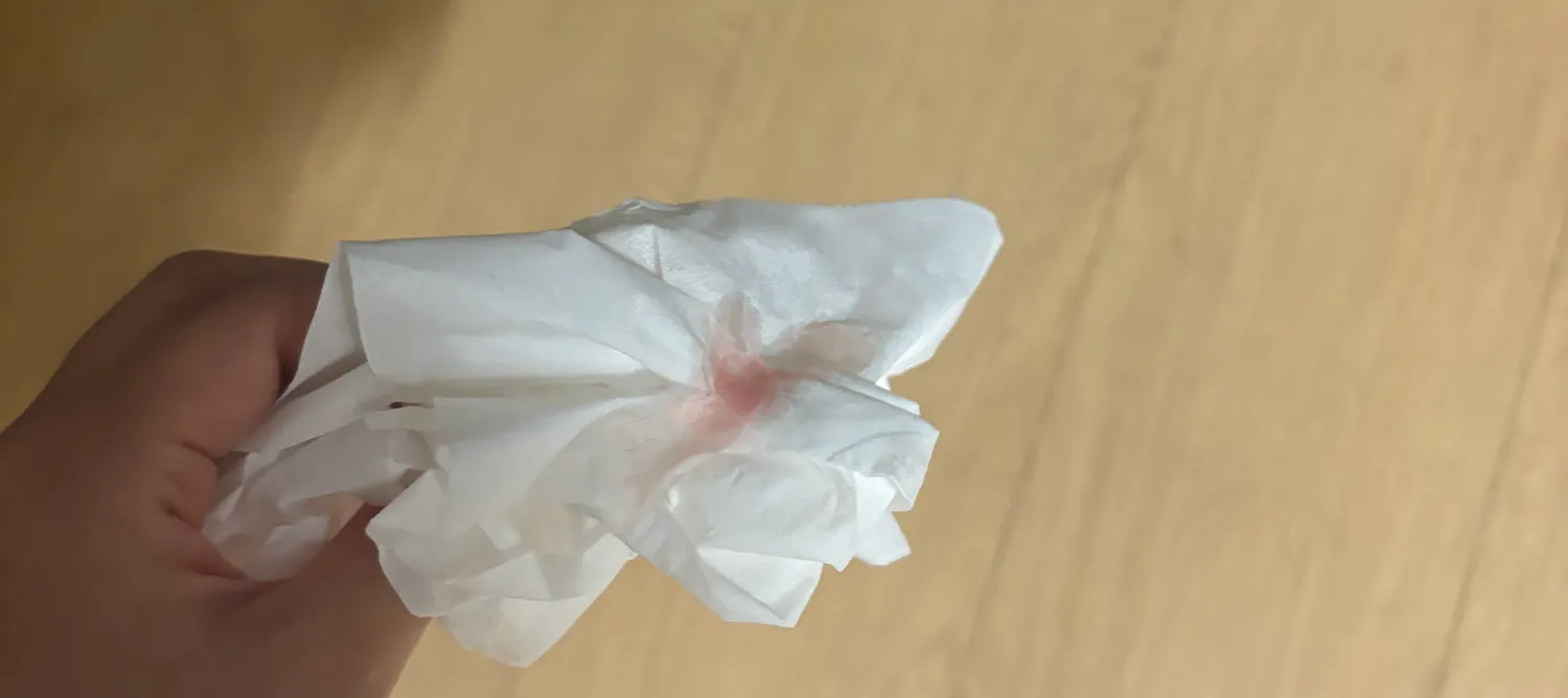멈머 피하수액 맞춰본적 있는 언니 있어요?