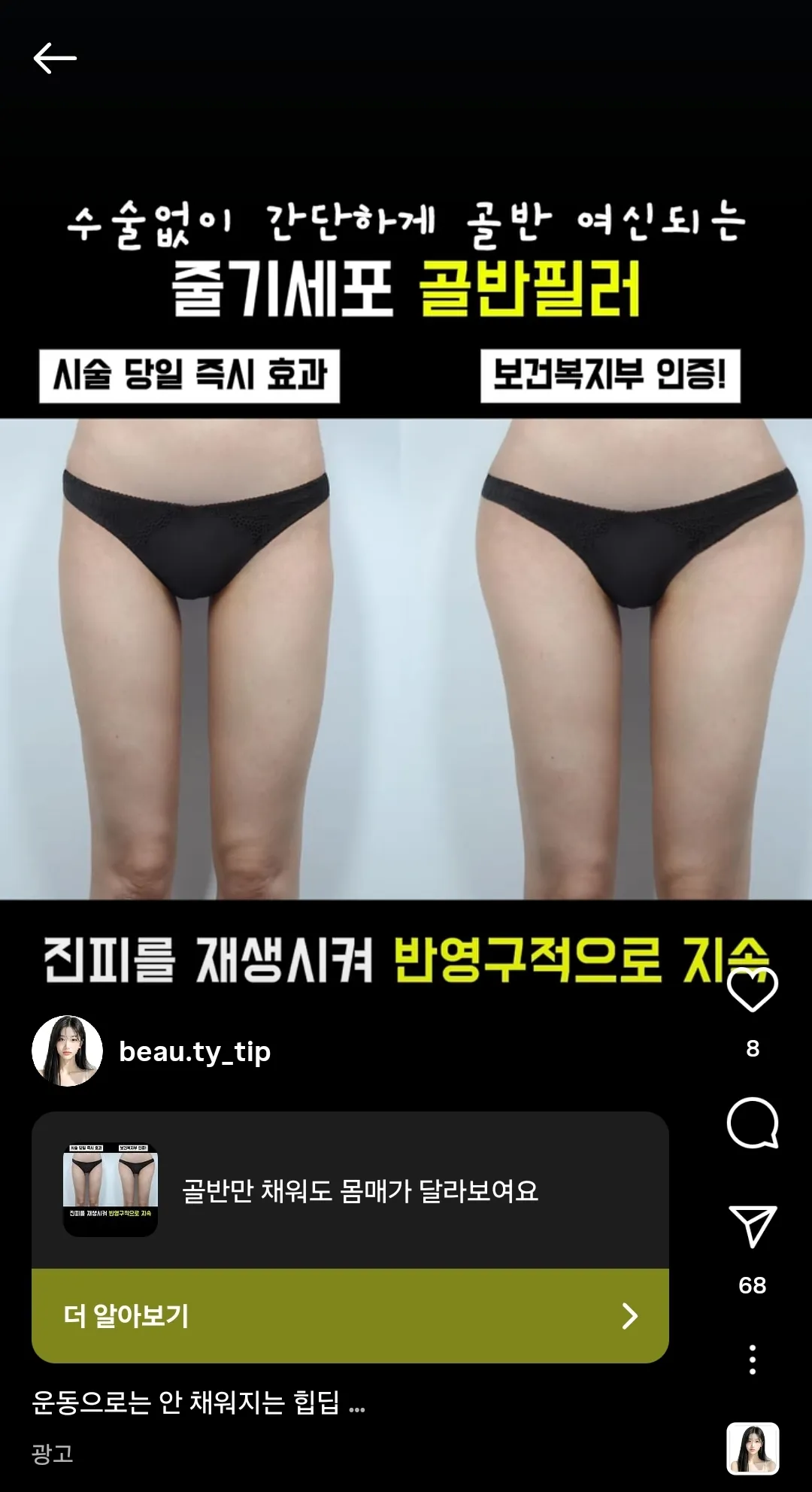 이게 진짜 이뻐보인다고 생각한걸까?