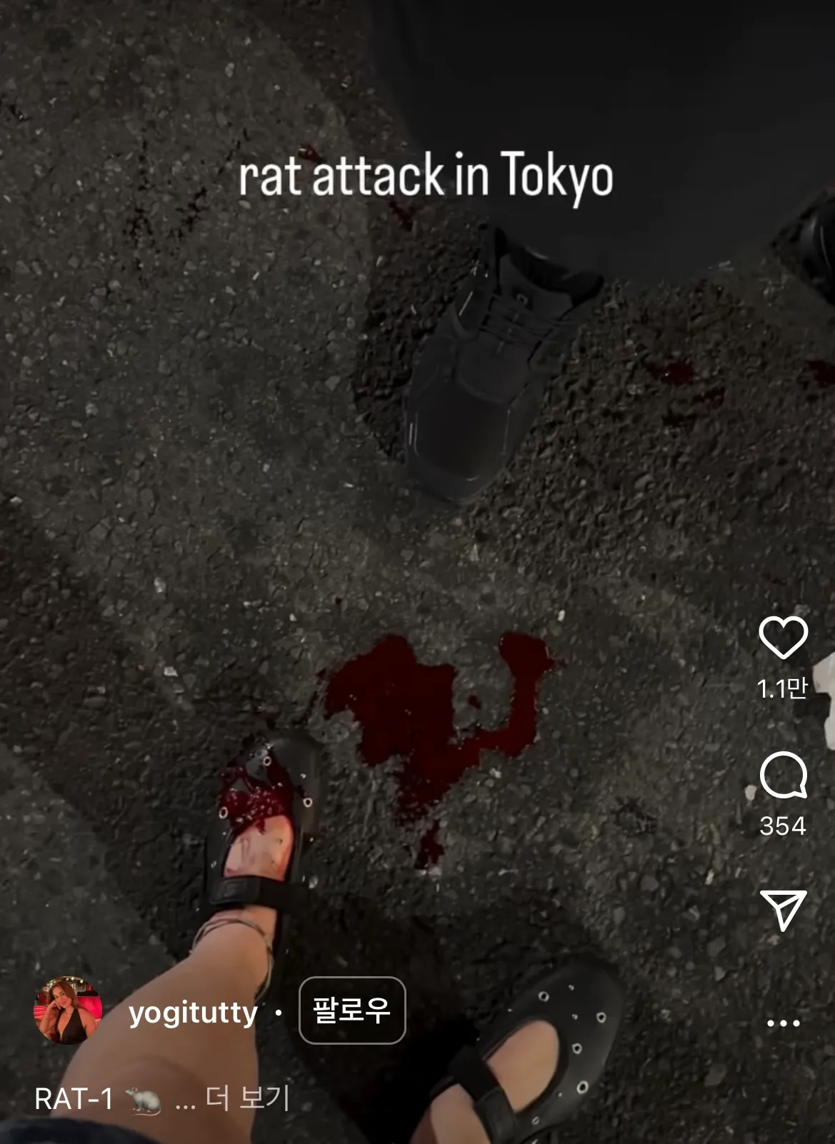 혐주의) 도쿄 신주쿠 걷다가 쥐한테 물린 관광객2