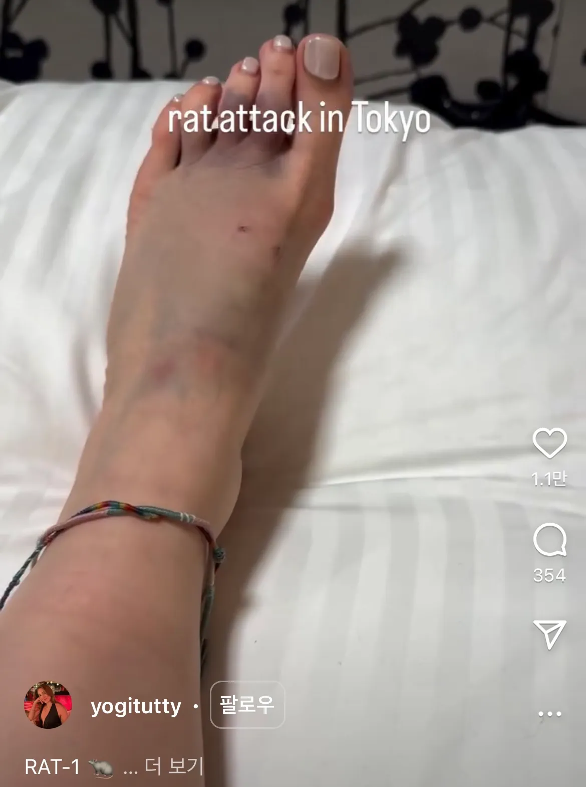 혐주의) 도쿄 신주쿠 걷다가 쥐한테 물린 관광객5