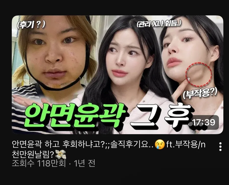 윤곽 후기보는데 개무섭네요