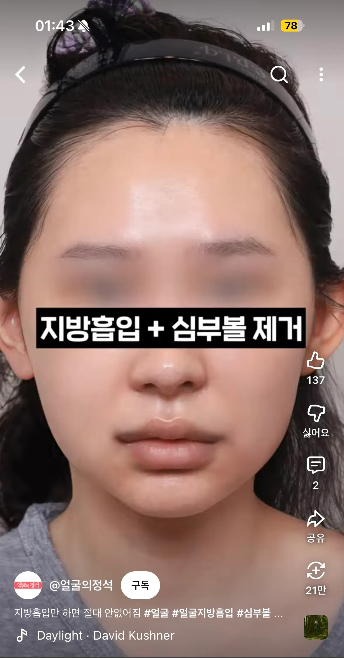1얼굴형이 완전 전데
