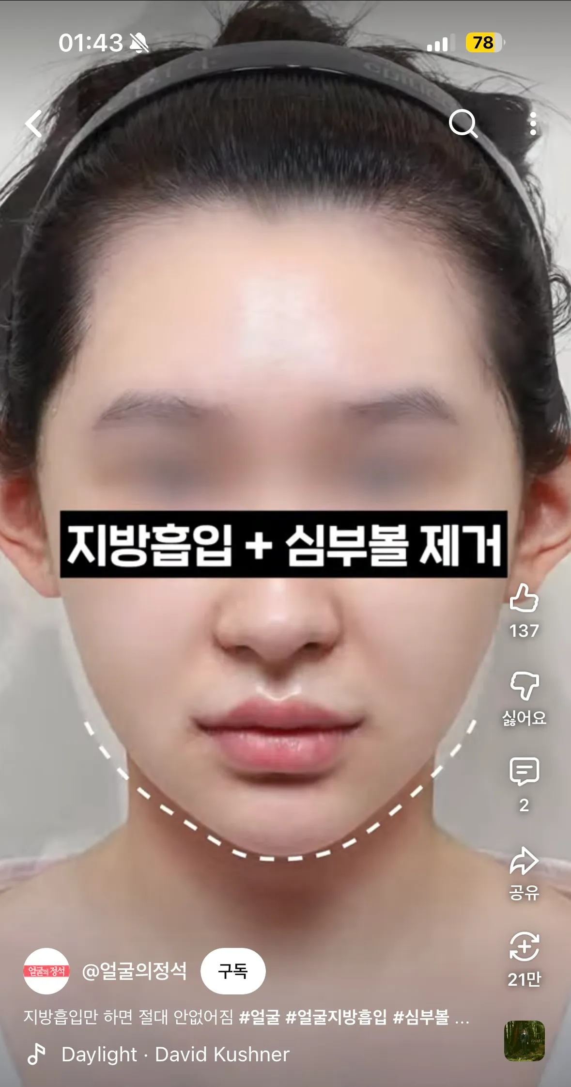 1얼굴형이 완전 전데2