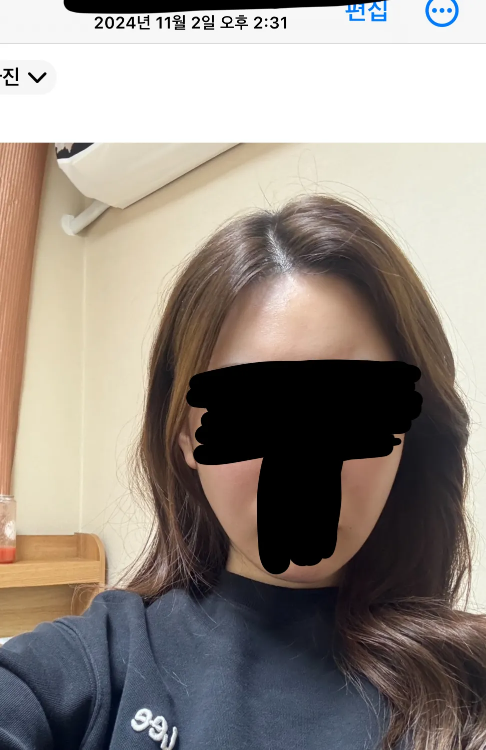 1년동안 시술만 받았는데 어때여??