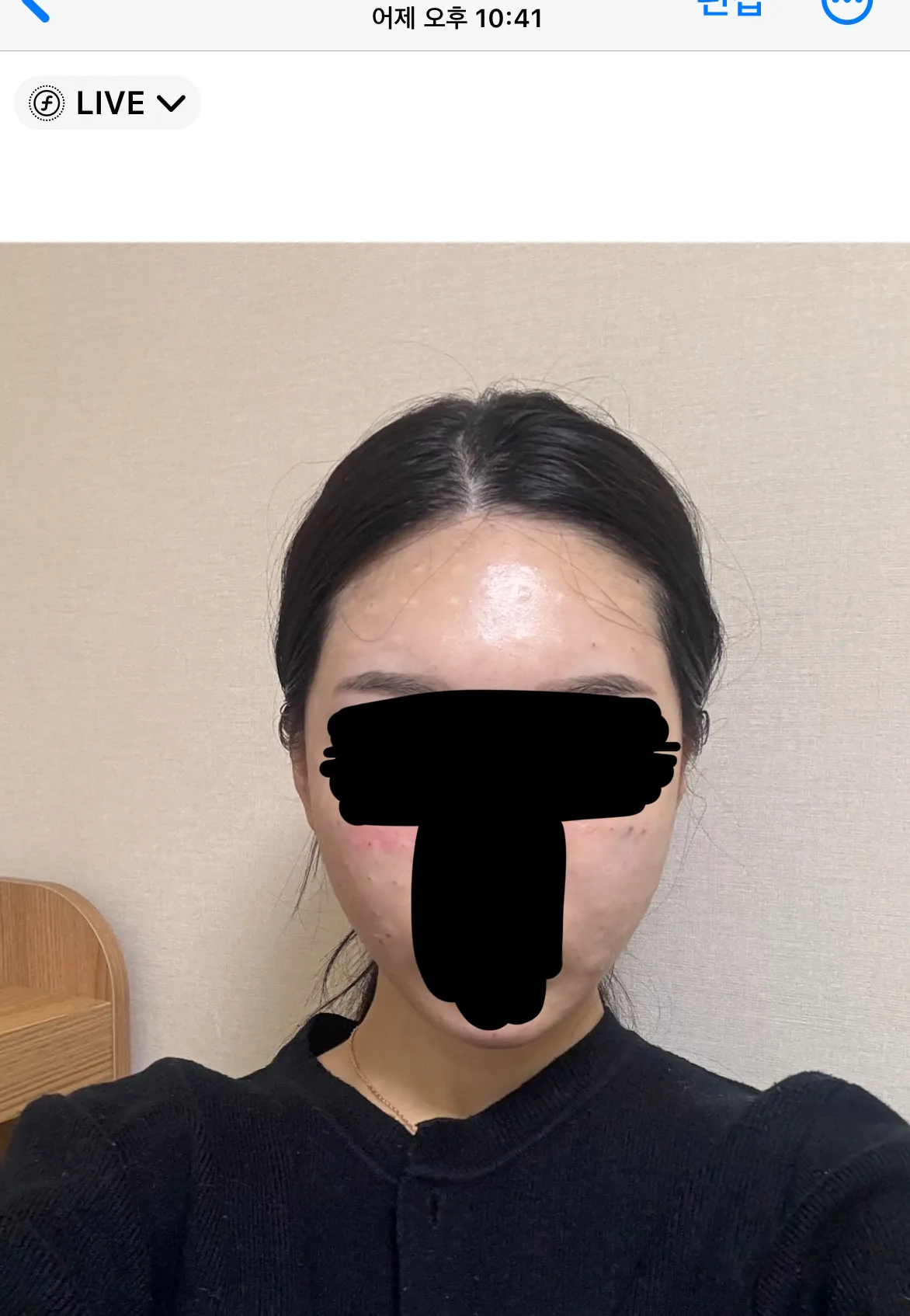 1년동안 시술만 받았는데 어때여??2