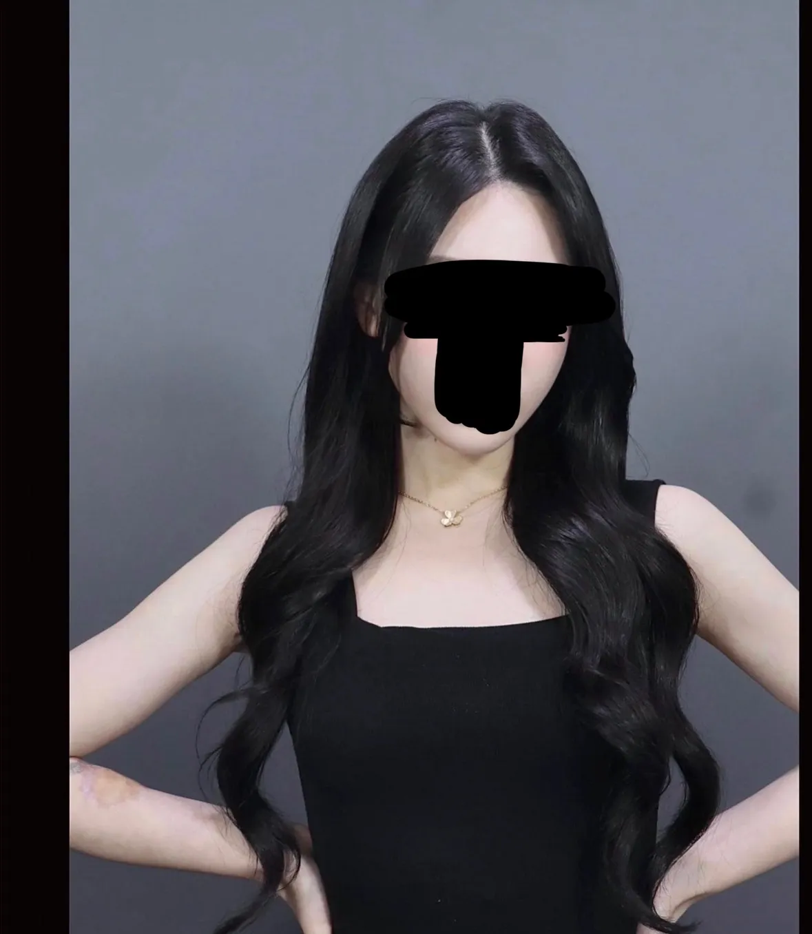 1년동안 시술만 받았는데 어때여??3