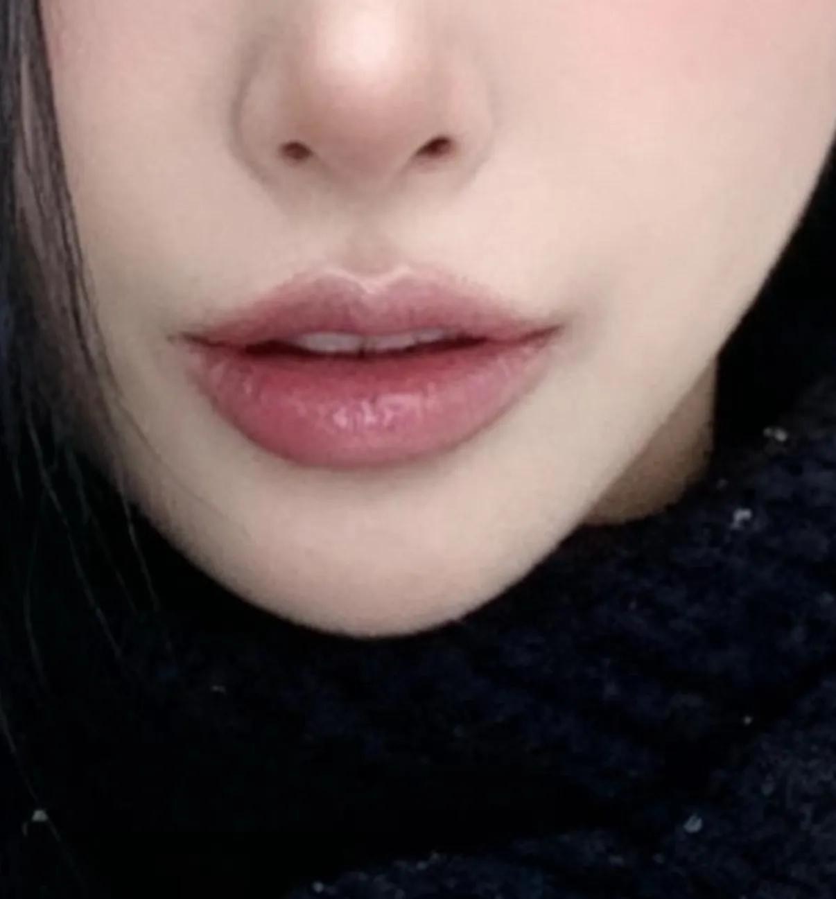 이런 입술 어디가야할까요