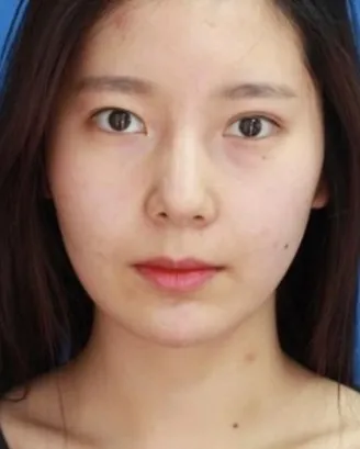 야옹이작가 성형전도 이정도면이쁜건가요