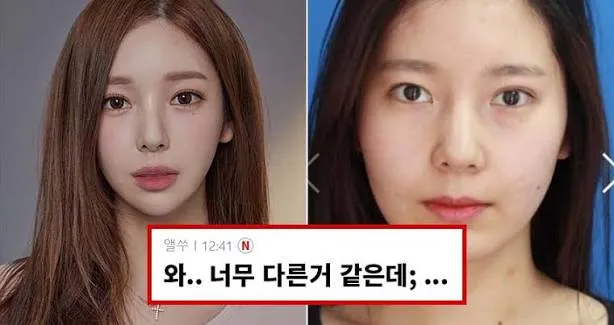 야옹이작가 성형전도 이정도면이쁜건가요3