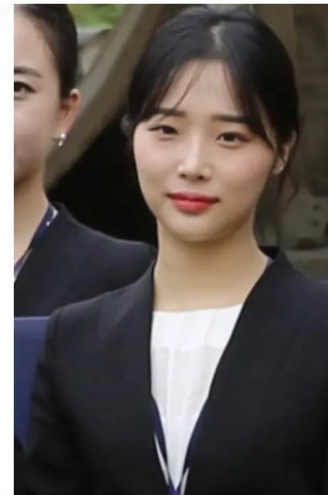 이분 양악아ㅣ구 윤곽이죠