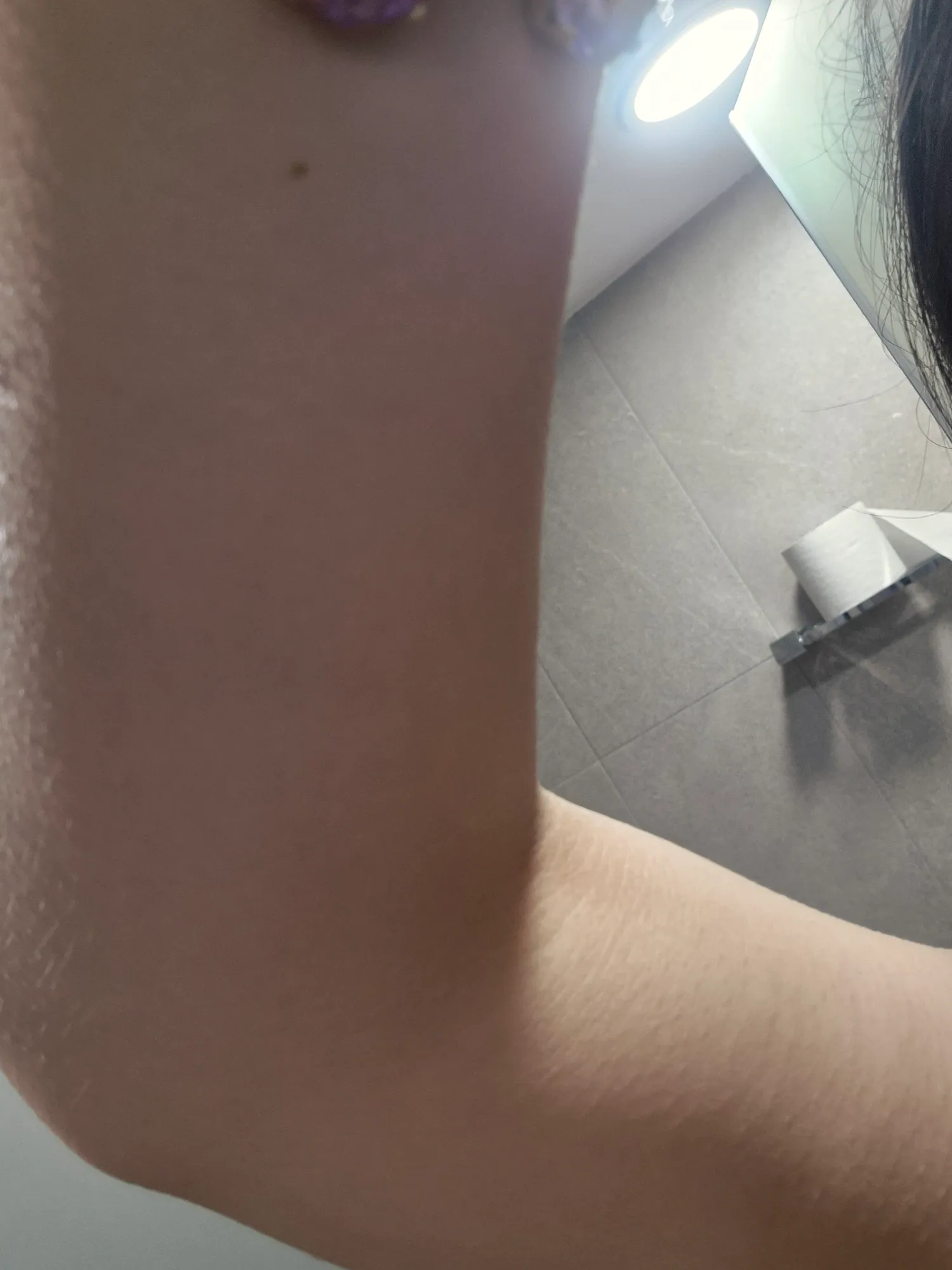 몸에 작은점도 다빼면 정병인가요2