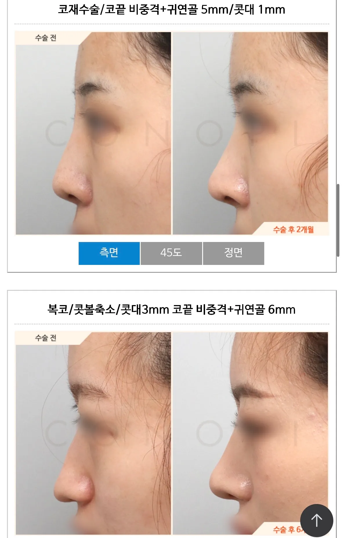 지금 첫수 코 맘에드는데 코끝만 너무 낮거든요..?