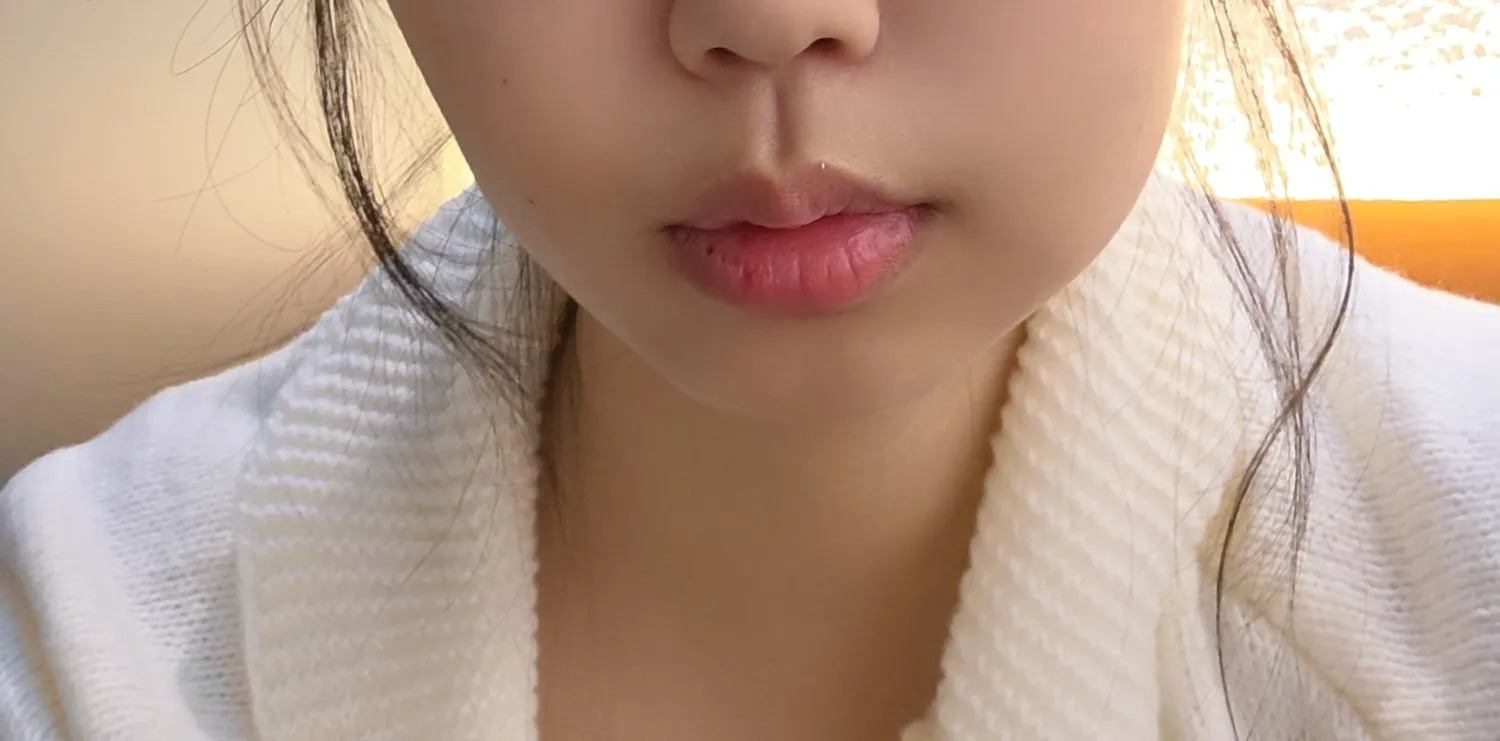 붇기 누가봐도 싶한거 같죠?ㅠㅜ