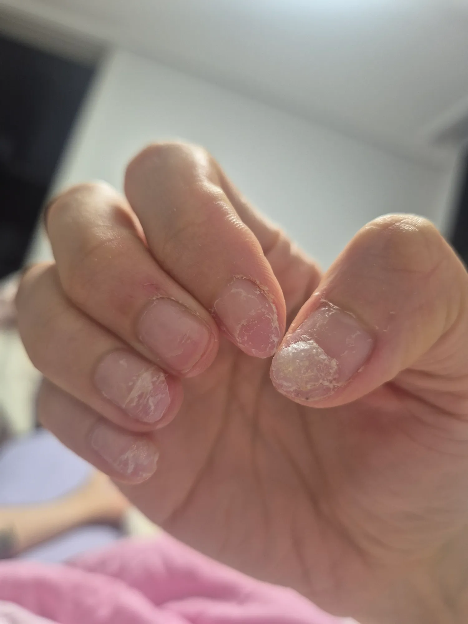 네일아트6년가까이안쉬고햇더니 손톱이