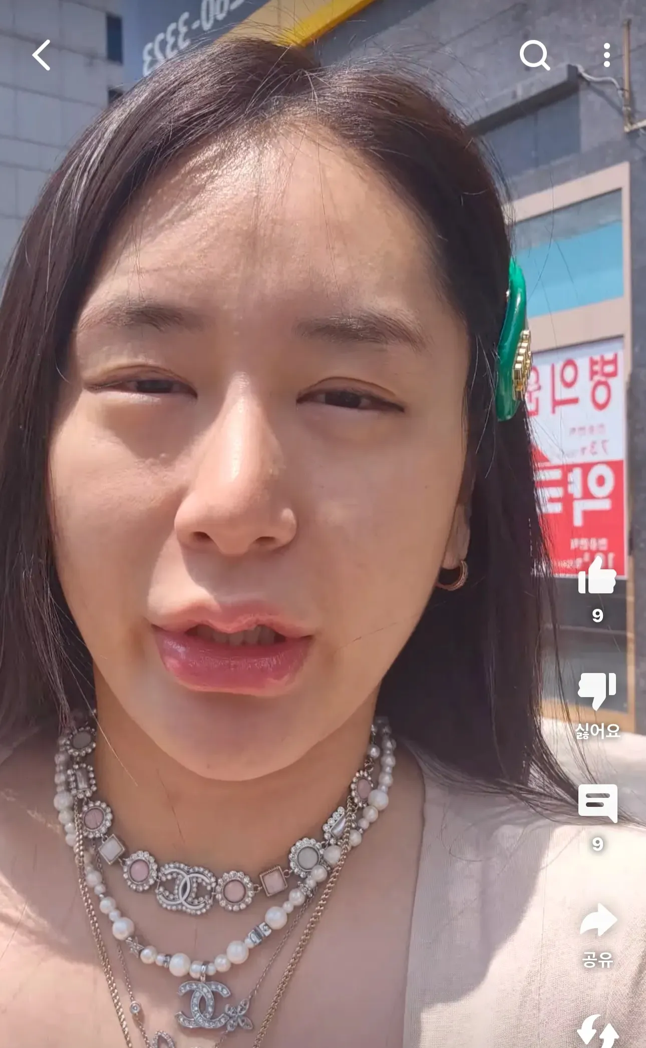 명품보석들 정리중... 써지컬쇠냄새 어케없애죠 댓글