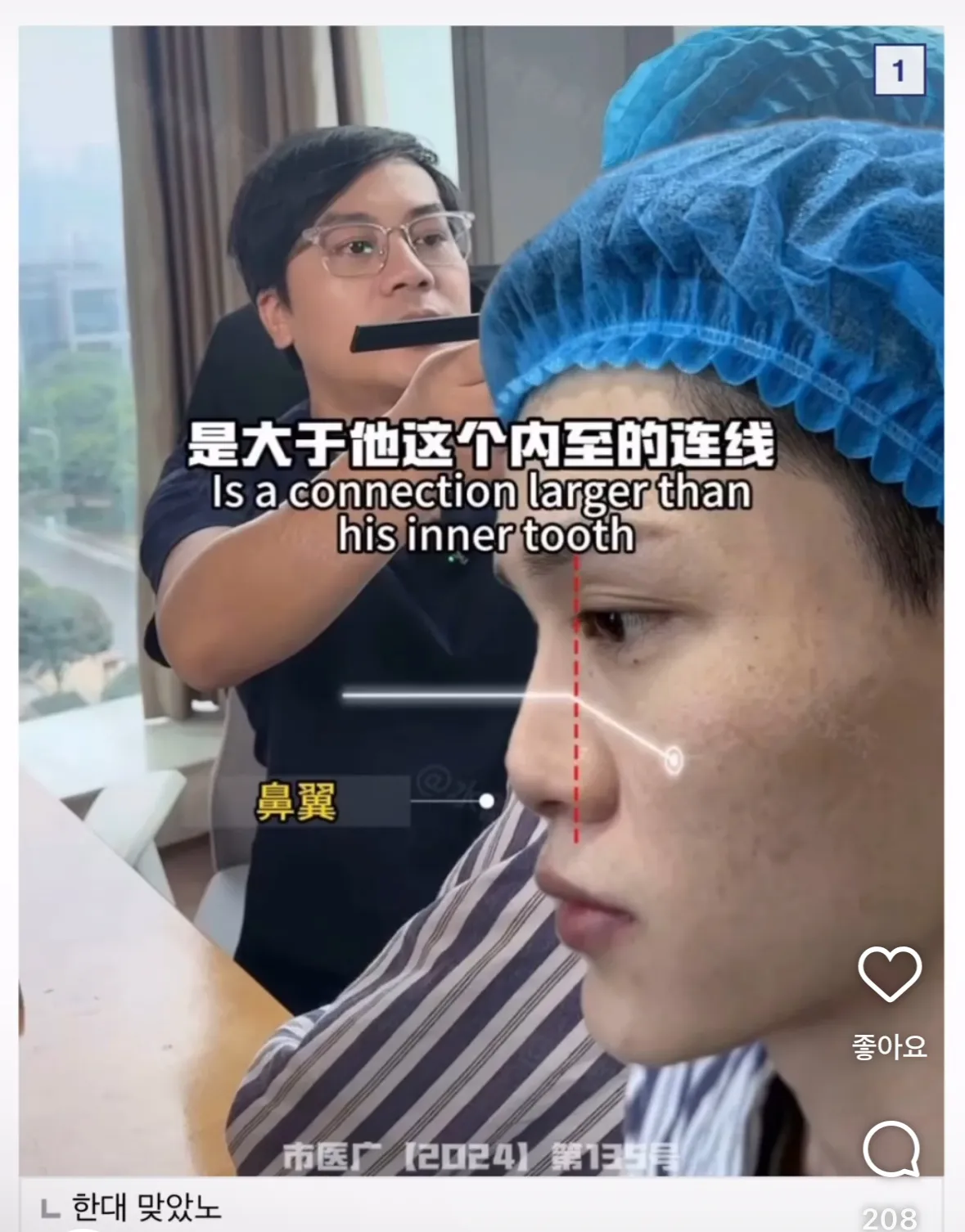 이래서 중국에서 코수술 하고 비싸구나...