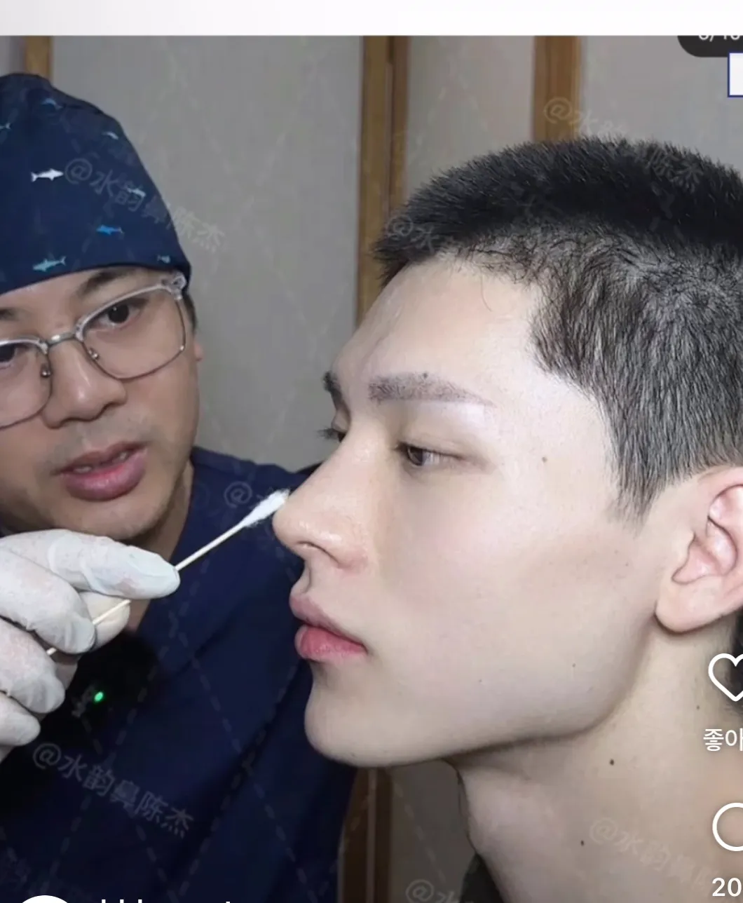 이래서 중국에서 코수술 하고 비싸구나...2