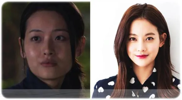 언냐 어느병원서 턱 광대깎앗노