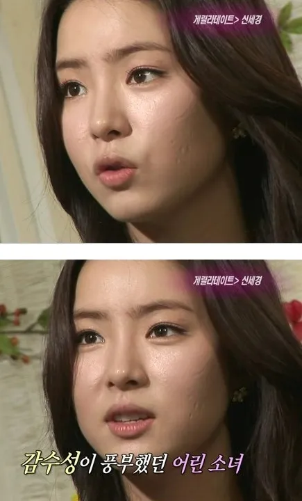 신세경 피부 파인흉터ㅜㅜ