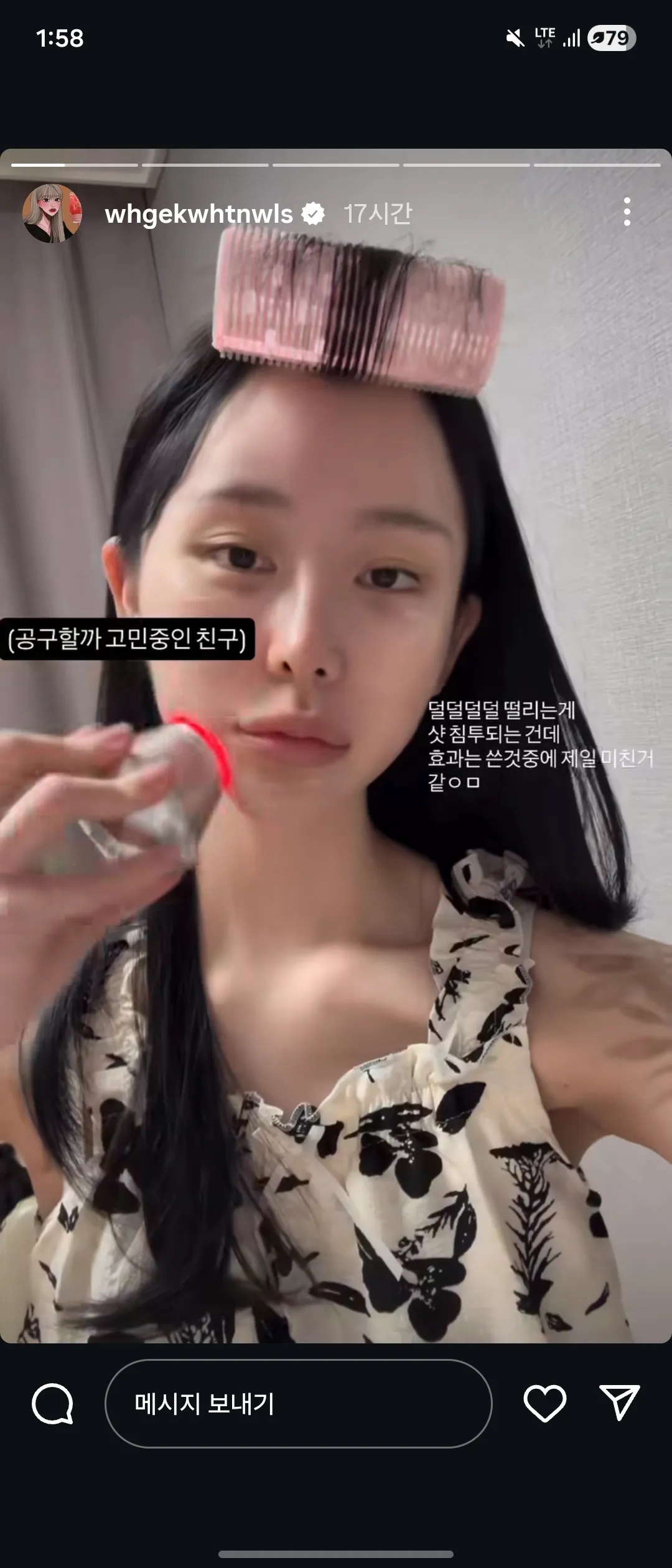 이게 이쁨? 조두팔